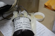 Avances de Donación de Sangre en Guatemala